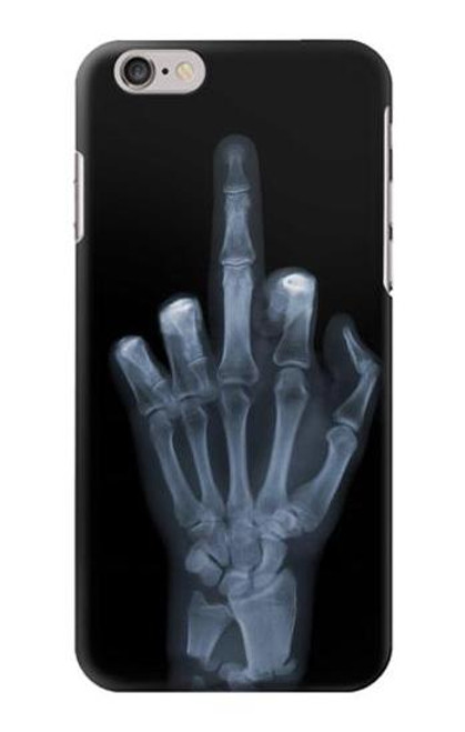 S1143 X-ray Hand Middle Finger Case For iPhone 6 6S