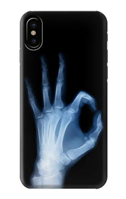 S3239 X-Ray Hand Sign OK Case For iPhone 7, iPhone 8