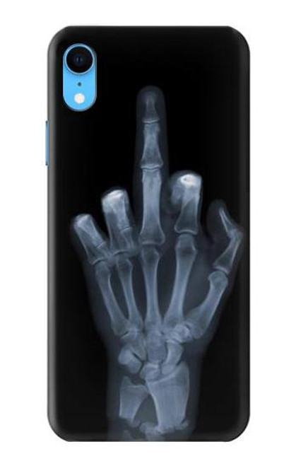 S1143 X-ray Hand Middle Finger Case For iPhone XR