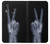 S3101 X-ray Peace Sign Fingers Case For Samsung Galaxy A20e
