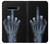 S1143 X-ray Hand Middle Finger Case For LG V60 ThinQ 5G