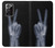 S3101 X-ray Peace Sign Fingers Case For Samsung Galaxy Note 20 Ultra, Ultra 5G S3101 X-ray Peace Sign Fingers Case For Samsung Galaxy Note 20 Ultra, Ultra 5G