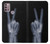 S3101 X-ray Peace Sign Fingers Case For Motorola Moto G30, G20, G10