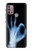 S3239 X-Ray Hand Sign OK Case For Motorola Moto G30, G20, G10