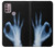 S3239 X-Ray Hand Sign OK Case For Motorola Moto G30, G20, G10