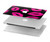 S2933 Pink Lips Kisses on Black Hard Case For MacBook 12″ - A1534