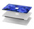 S0782 Forget me not Hard Case For MacBook Pro Retina 13″ - A1425, A1502