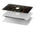 S2649 Unfiltered Poison Vintage Glass Bottle Hard Case For MacBook Pro Retina 13″ - A1425, A1502
