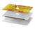 S3315 Spain Flag Vintage Football Graphic Hard Case For MacBook Pro Retina 13″ - A1425, A1502