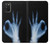 S3239 X-Ray Hand Sign OK Case For Samsung Galaxy A03S