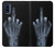 S1143 X-ray Hand Middle Finger Case For Motorola G Pure