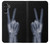 S3101 X-ray Peace Sign Fingers Case For Samsung Galaxy A13 5G