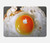 S2695 Fried Egg Hard Case For MacBook Pro 14 M1-M5 A2442,A2779,A2992,A2918,A3112,A3185,A3401,A3434,A3112