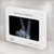 S3101 X-ray Peace Sign Fingers Hard Case For MacBook Pro 16 M1,M2 (2021,2023) - A2485, A2780