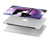 S3284 Sexy Girl Disco Pole Dance Hard Case For MacBook Pro 16 M1,M2 (2021,2023) - A2485, A2780