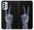 S3101 X-ray Peace Sign Fingers Case For Samsung Galaxy A23