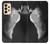 S1593 Ballet Pointe Shoe Case For Samsung Galaxy A33 5G
