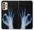 S3239 X-Ray Hand Sign OK Case For Samsung Galaxy A33 5G
