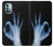 S3239 X-Ray Hand Sign OK Case For Nokia G11, G21