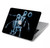 S1111 Soccer X-ray Hard Case For MacBook Air 13″ (2022,2024) - A2681, A3113
