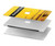 S3714 Radiation Warning Hard Case For MacBook Air 13″ (2022,2025) - A2681, A3113, A3240