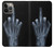 S1143 X-ray Hand Middle Finger Case For iPhone 14 Pro