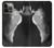 S1593 Ballet Pointe Shoe Case For iPhone 14 Pro Max