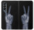 S3101 X-ray Peace Sign Fingers Case For Samsung Galaxy Z Fold 4