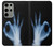 S3239 X-Ray Hand Sign OK Case For Samsung Galaxy S23 Ultra