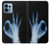 S3239 X-Ray Hand Sign OK Case For Motorola Edge+ (2023), X40, X40 Pro, Edge 40 Pro