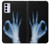 S3239 X-Ray Hand Sign OK Case For Motorola Moto G42