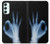 S3239 X-Ray Hand Sign OK Case For Samsung Galaxy A34 5G