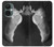S1593 Ballet Pointe Shoe Case For OnePlus Nord CE 3 Lite, Nord N30 5G