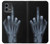 S1143 X-ray Hand Middle Finger Case For Motorola Moto G Stylus 5G (2023)