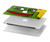 S3945 Pepe Love Middle Finger Hard Case For MacBook Pro 14 M1,M2,M3 (2021,2023) - A2442, A2779, A2992, A2918