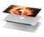S0493 Music Note Burn Hard Case For MacBook Air 15″ (2023,2024) - A2941, A3114