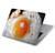 S2695 Fried Egg Hard Case For MacBook Air 15″ (2023,2024,2025) - A2941, A3114, A3241