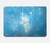 S2923 Frozen Snow Spell Magic Hard Case For MacBook Air 15″ (2023,2024,2025) - A2941, A3114, A3241