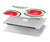 S3236 Watermelon Pattern Hard Case For MacBook Air 15″ (2023,2024) - A2941, A3114