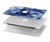 S3439 Fabric Indigo Tie Dye Hard Case For MacBook Air 15″ (2023,2024,2025) - A2941, A3114, A3241