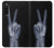 S3101 X-ray Peace Sign Fingers Case For Sony Xperia 10 V
