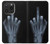 S1143 X-ray Hand Middle Finger Case For iPhone 15 Pro