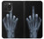 S1143 X-ray Hand Middle Finger Case For iPhone 15 Pro Max