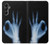 S3239 X-Ray Hand Sign OK Case For Samsung Galaxy A05s