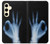 S3239 X-Ray Hand Sign OK Case For Samsung Galaxy S24