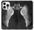 S1593 Ballet Pointe Shoe Case For iPhone 16 pro