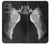 S1593 Ballet Pointe Shoe Case For Motorola Moto G14