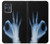 S3239 X-Ray Hand Sign OK Case For Motorola Moto G54