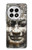 S0314 Ancient Cambodian Buddhism Case For OnePlus 13