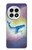 S3802 Dream Whale Pastel Fantasy Case For OnePlus 13